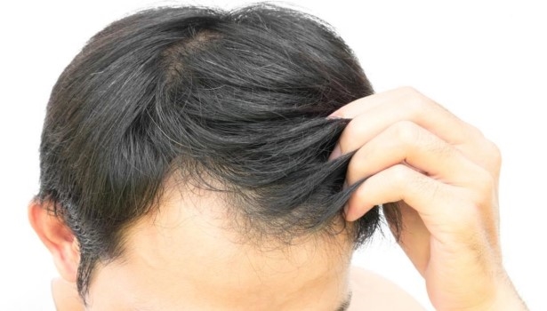 Siwe włosy męskie – jak im zapobiec