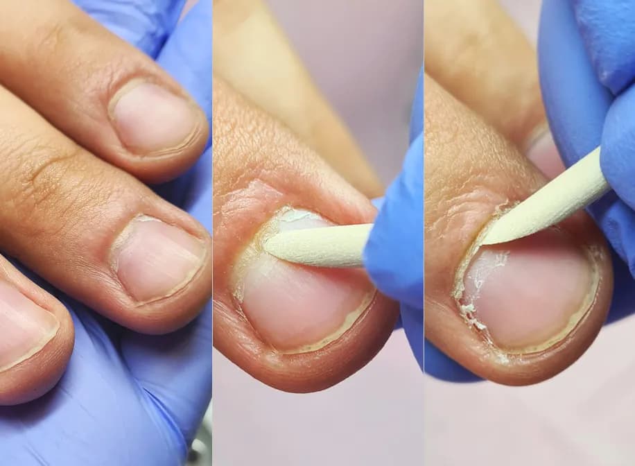 Manicure męski na czym polega? Poznaj etapy i zyskaj zdrowe dłonie Manicure męski na czym polega? Poznaj etapy i zyskaj zdrowe dłonie